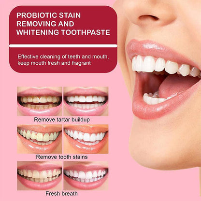 🔥2024 HOT SALE🔥SP-6 Probiotic Whitening Toothpaste