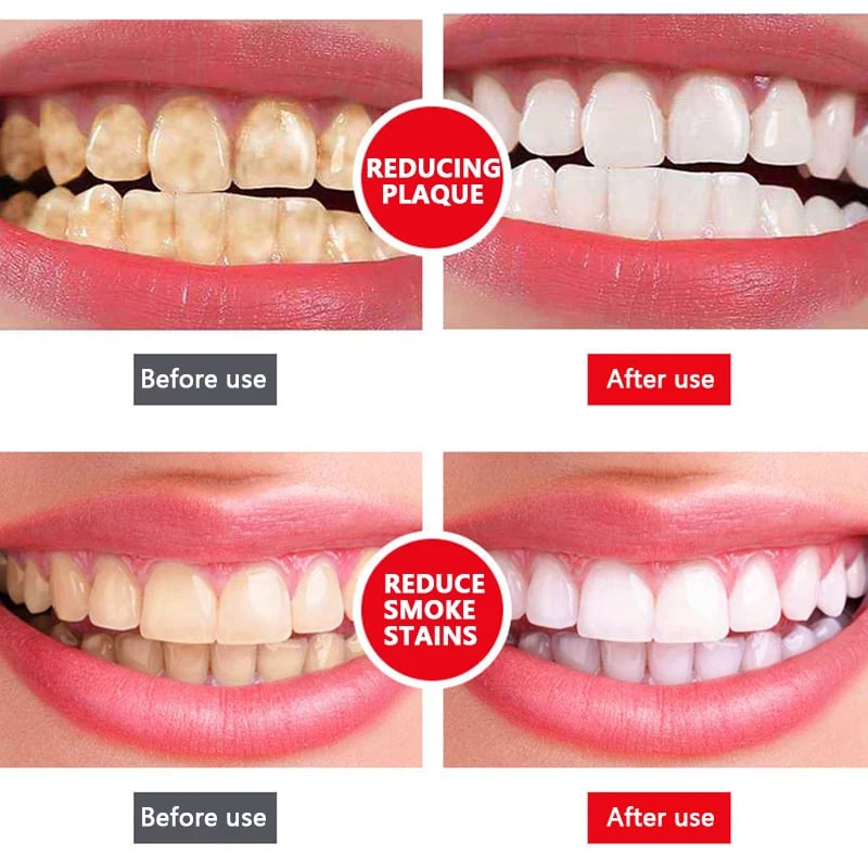 🔥2024 HOT SALE🔥SP-6 Probiotic Whitening Toothpaste