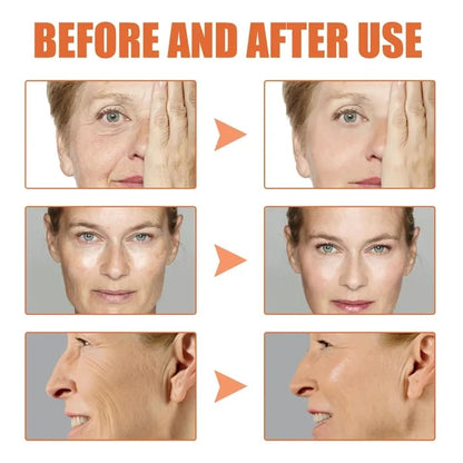 🔥Last Day Promotion 49% OFF🔥-Botox Face Serum